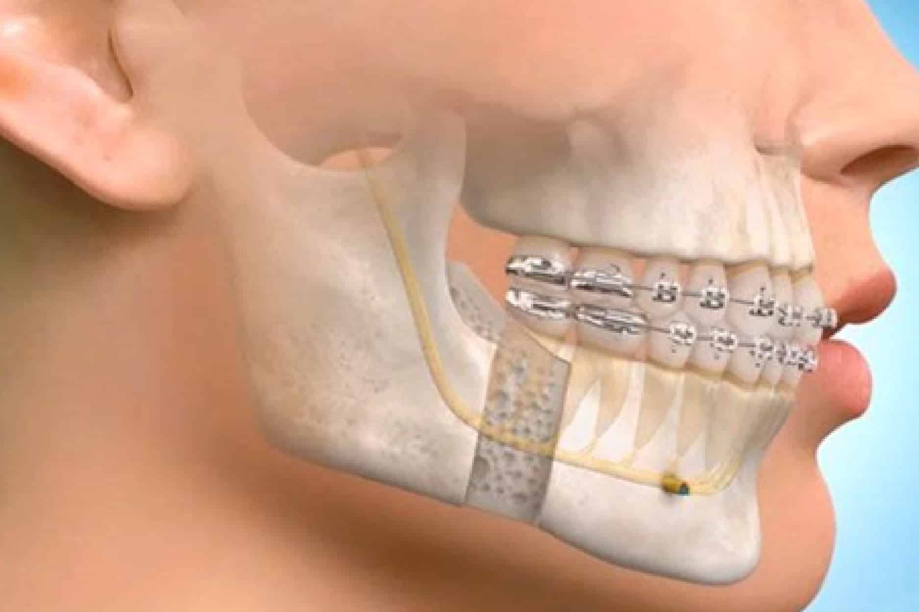 Crowns and bridges in lucknow, Best dentures in lucknow, Best maxillofacial surgeon in lucknow, Best dentist in Lucknow, dentist in Lucknow